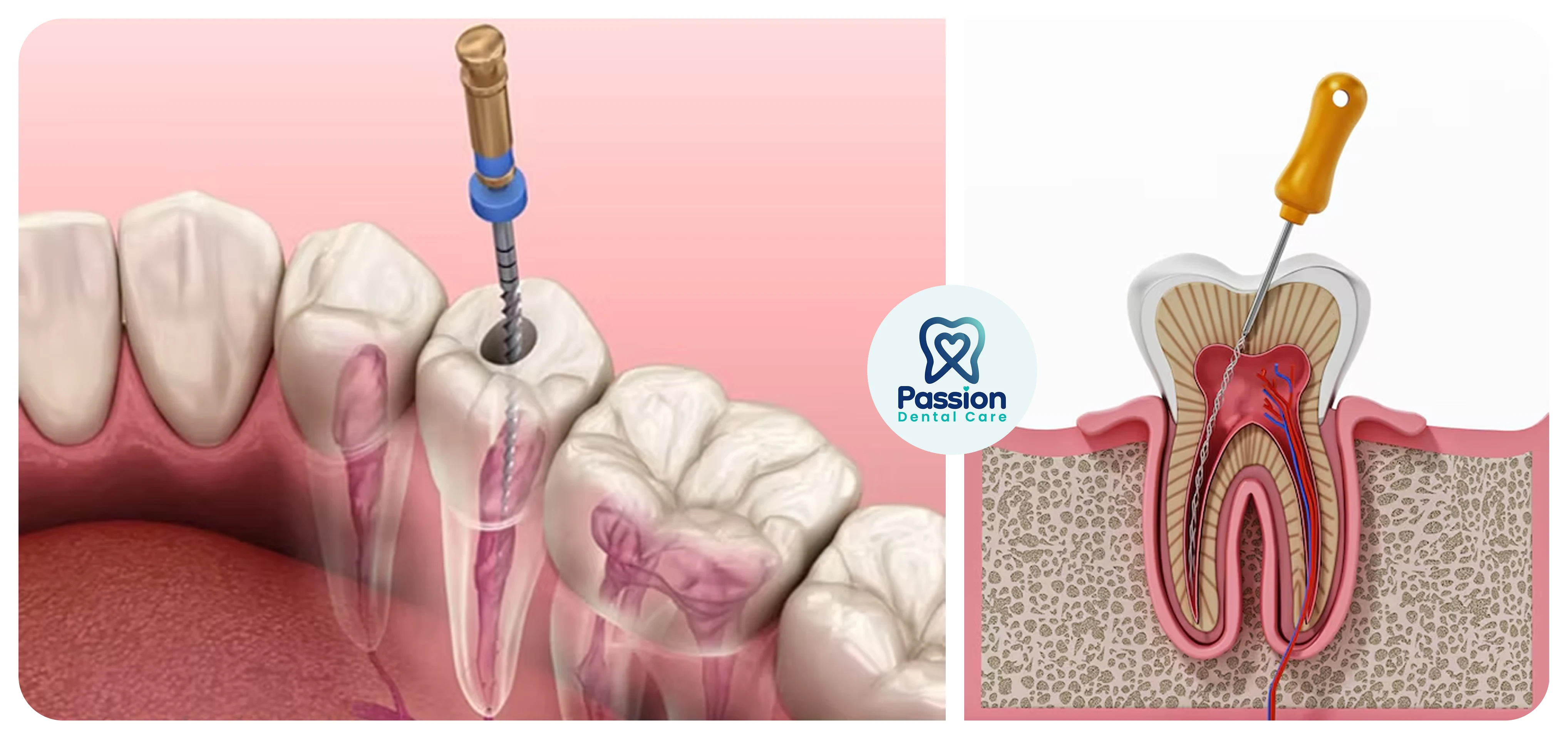 Hasil perawatan {{ result?.title }} Passion Dental Care