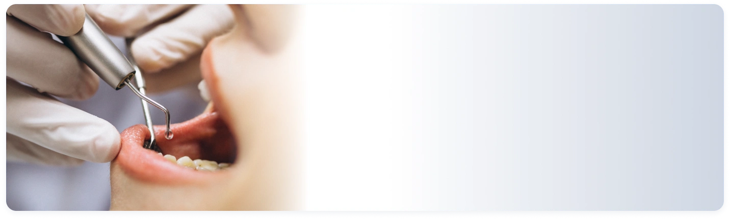 Layanan {{ result?.title }} Passion Dental Care