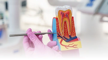 Layanan {{ result?.title }} Passion Dental Care