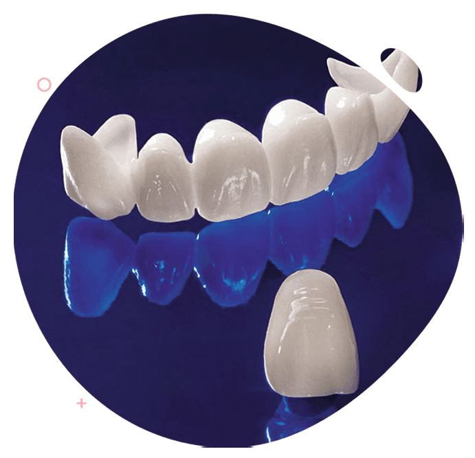 https://www.passiondentalcare.com/wp-content/uploads/2022/12/crown-bridge-acrylic-images-min.png