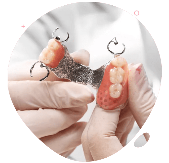 https://www.passiondentalcare.com/wp-content/uploads/2022/12/frame-denture-images.png