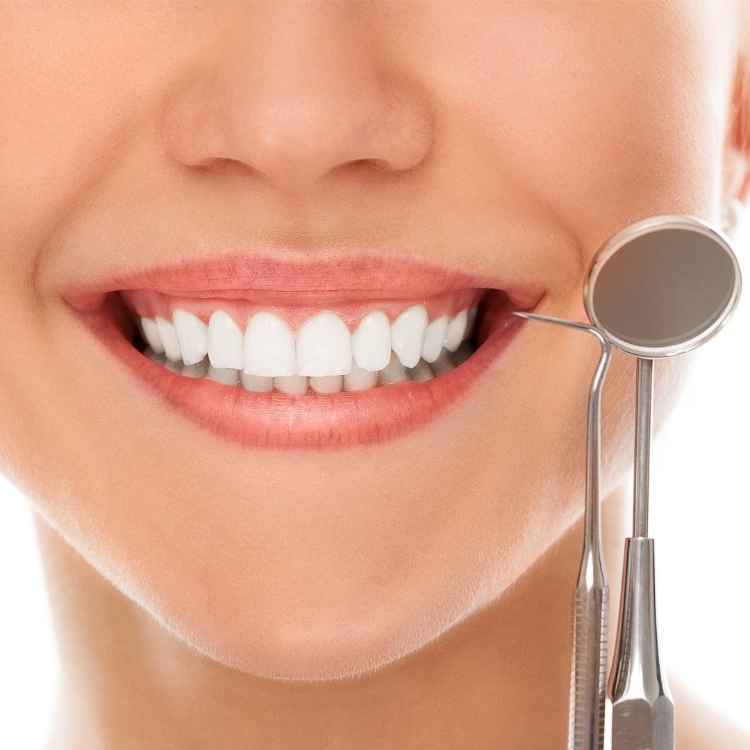 https://www.passiondentalcare.com/wp-content/uploads/2022/12/gum-lifting-images-1-min.jpg