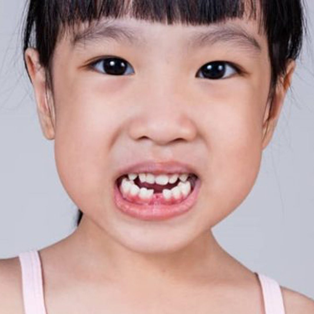 perawatan-gigi-anak-images-3