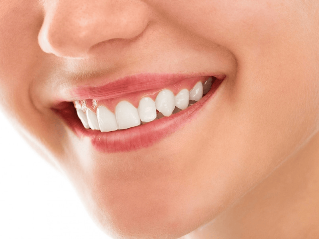 Ingin Memutihkan Gigi Secara Alami? Ini 6 Cara yang Bisa Kamu Lakukan!