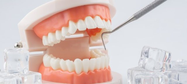 Harga Scaling Gigi di Klinik Bandung Passion Dental Care