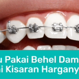 behel damon | Passion Dental Care