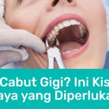 biaya cabut gigi | Passion Dental Care