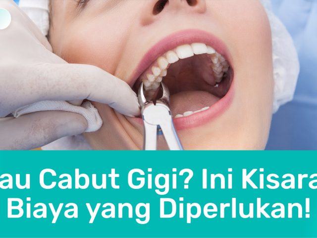 Ini Kisaran Biaya Cabut Gigi di Klinik Gigi Bandung!